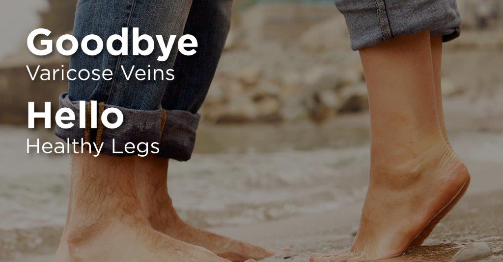 Varicose Vein Removal Surgery Kingsbridge Private Hospital Belfast