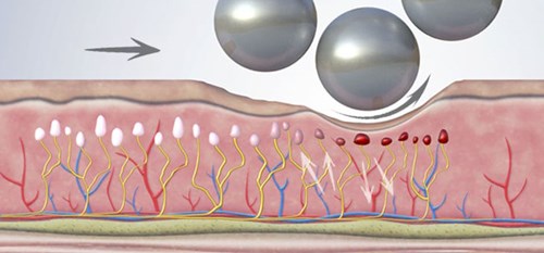 Endospheres Anagesic Action
